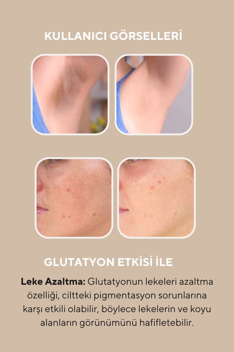 The Ceel Cilt Beyazlatıcı Aydınlatıcı Glutatyonlu Leke Karşıtı Krem Kolajen, Niacinamide & Kojik Asitli 50 ml