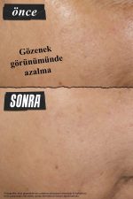 Kiehl's Siyah Nokta Karşıtı ve Gözenekleri Derinlemesine Arındıran Rare Earth Kil Maskesi 125 ml