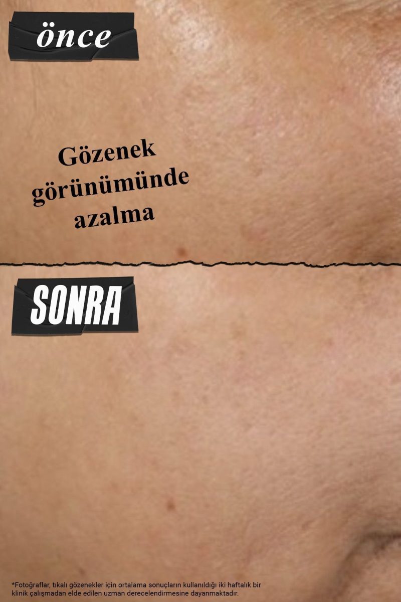 Kiehl's Siyah Nokta Karşıtı ve Gözenekleri Derinlemesine Arındıran Rare Earth Kil Maskesi 125 ml