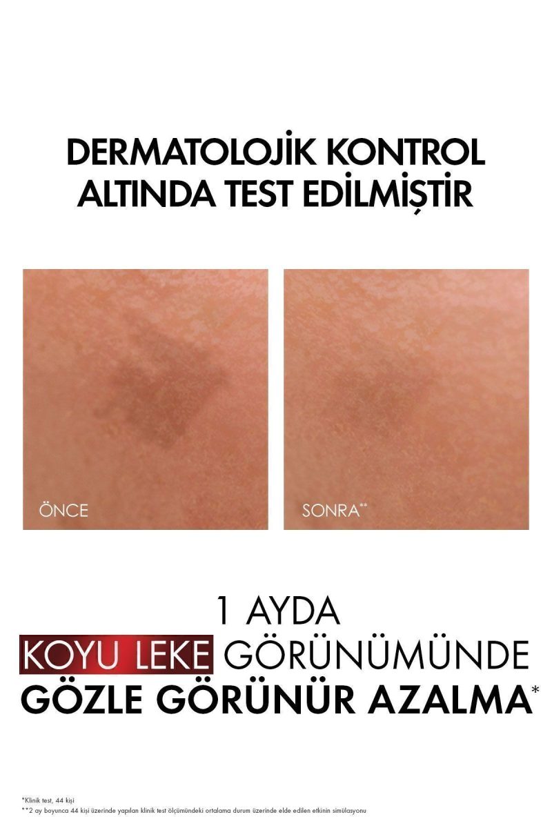 Vichy Liftactiv Pigment Specialist B3 Koyu Leke Karşıtı Serum 30 ml
